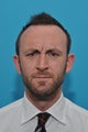 27-year-old male treated with BOTOX for Deep Forehead lines