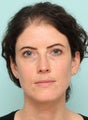 BroadBand Light (BBL/IPL), MicroLaserPeel, ProFractional Laser Resurfacing