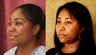 African American Rhinoplasty