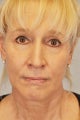 Woman gets a brighter look on life