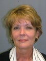 Liposuction, LiteLift™ on 58-year-old Woman