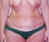 37 year old female patient