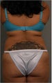 33 year old with stubborn waist fat and bra roll