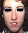 28 year old female patient