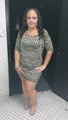 Bariartic Surgery: Gastric Sleeve