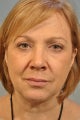 Woman undergoes several procedures.