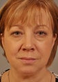 Woman undergoes several procedures.
