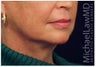 Facelift