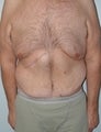 45 year old male patient
