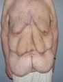 45 year old male patient