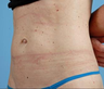 truSculpt