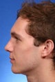 Chin implant combined with rhinoplasty