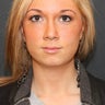 Chin Augmentation