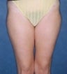 38 year old female patient