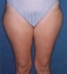 38 year old female patient