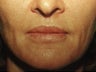 Lips