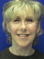 Facelift and Necklift