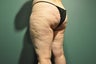 Cellulaze