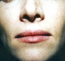 lip augmentation with fat