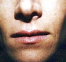 lip augmentation with fat