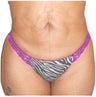 Smart Lipo with Tummy Tuck