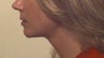 Chin implant