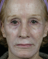 Pearl Fractional