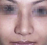 Nose