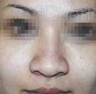 Nose