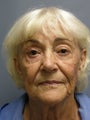 LiteLift™ and Blue Peel® on 79-year-old Woman