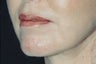 Lips