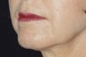 Lips