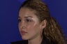 Revision Rhinoplasty