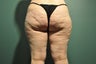 Cellulaze