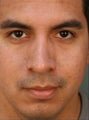 Hispanic Revision Rhinoplasty