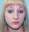 15 year old female patient