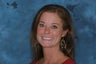 Cosmetic Dentistry with a small amount of teeth showing between her lips when smiling.