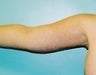 43 year old female patient