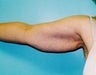 43 year old female patient