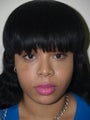 Before and After Buccal Fat Removal