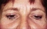 36 year old female patient