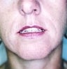 36 year old female patient