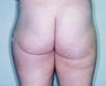 33 year old female patient