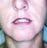 36 year old female patient