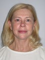 Mini Facelift, Blepharoplasty and Fat Transfers