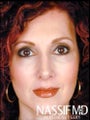 Female Primary Rhinoplasty