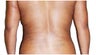 Smart Lipo