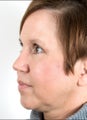 Prominent, drooping tip