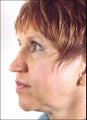 Prominent, drooping tip