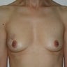 48 year old female patient